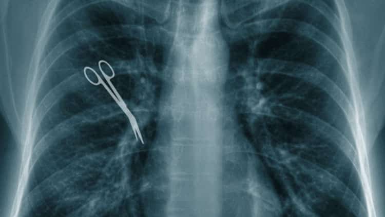 Wie müssen Patienten Behandlungsfehler von Ärzten nachweisen?