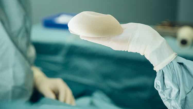 Mangelhafte Brustimplantate – Arzt trifft keine Schuld